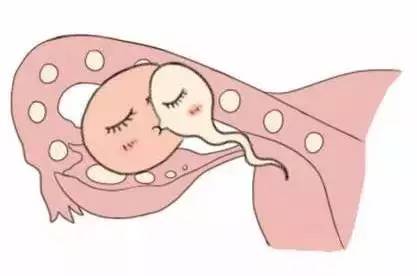 极光生殖